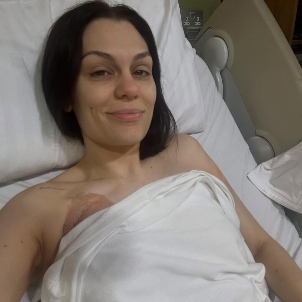 Jessie J comemora resultado de exames após cirurgia nos seios