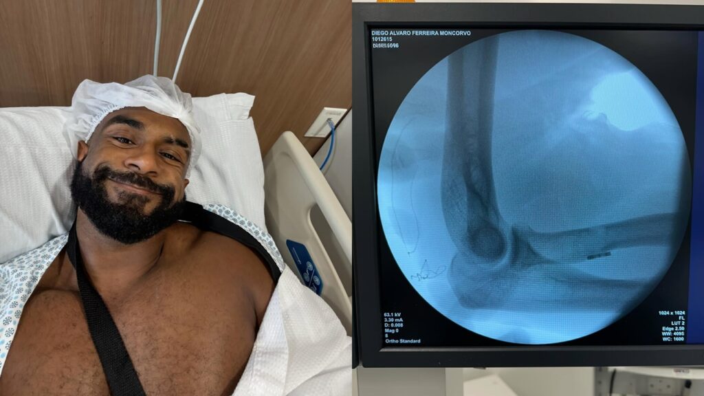 Baco Exu do Blues Tranquiliza Fãs Após Cirurgia e Confirma Turnê “HASOS” para Março