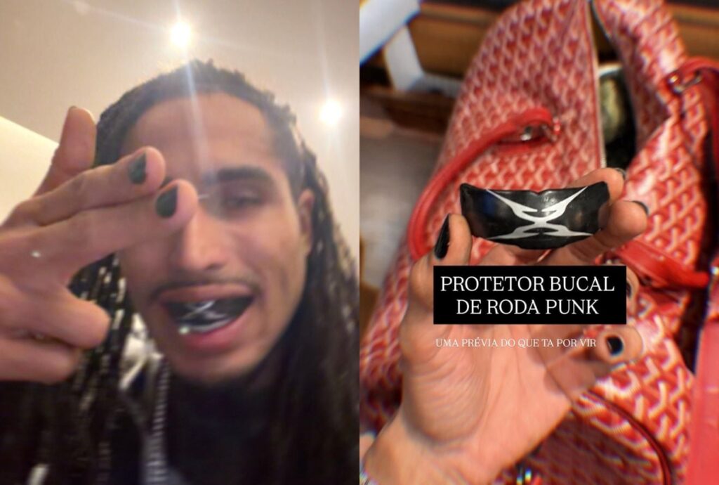 Matuê mostra "protetor bucal de roda punk" e fãs reagem