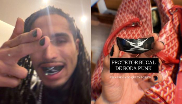 Matuê mostra "protetor bucal de roda punk" e fãs reagem
